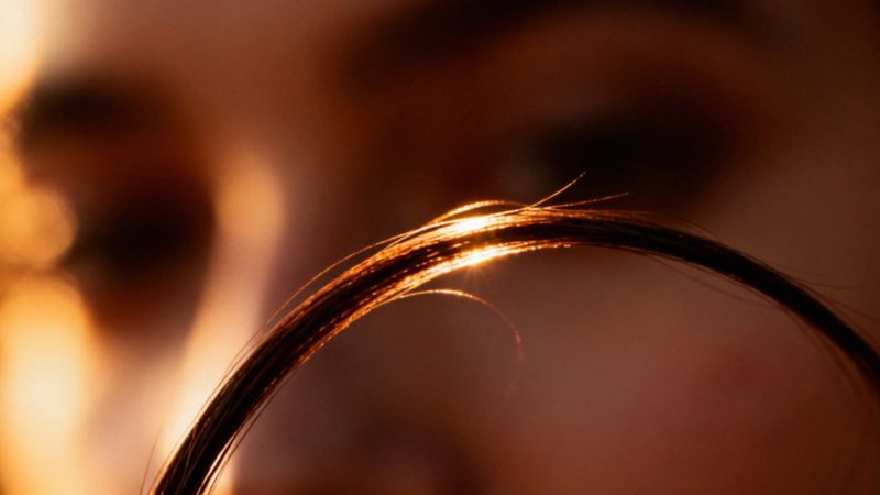Trichotillomania - co to jest i jak leczyć to zaburzenie?